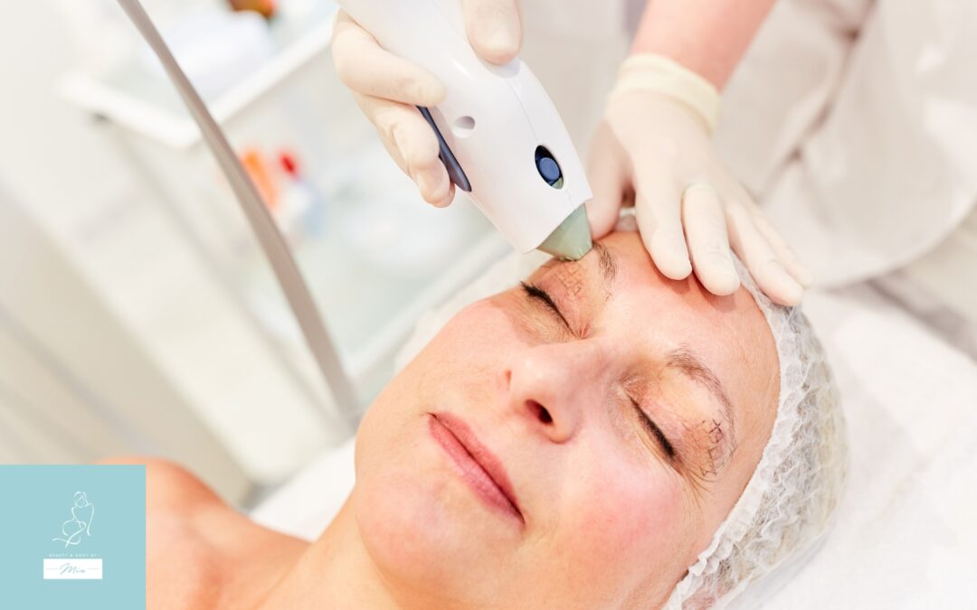 Is Thermage for Skin Toning Right for You?